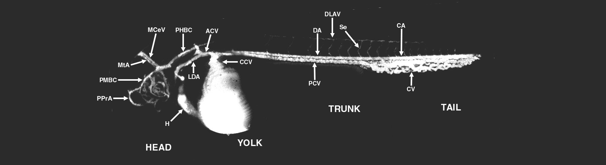 An Interactive Atlas of Zebrafish Vascular Anatomy